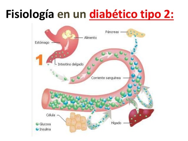 Bioquímica del desarrollo de la diabetes mellitus tipo 2 Bioquímica del desarrollo de la diabetes mellitus tipo 2