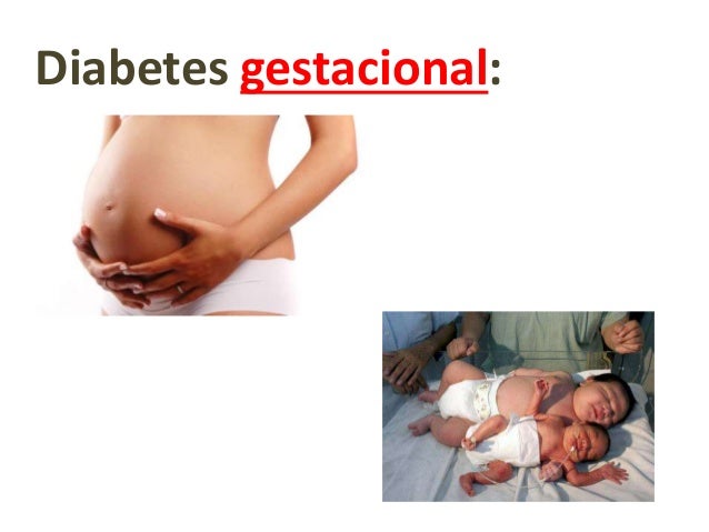 Bioquímica del desarrollo de la diabetes mellitus tipo 2 Bioquímica del desarrollo de la diabetes mellitus tipo 2