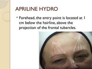 Skin aging process and his prevention by Biorevitalization | PPTX