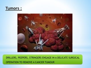 Tumors : 
DRILLERS, PEEPERS, STRINGERS ENGAGE IN A DELICATE SURGICAL 
OPERATION TO REMOVE A CANCER TUMOUR 
 