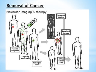 Removal of Cancer 
 
