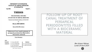 FOLLOW-UP OF ROOT
CANAL TREATMENT OF
PERIAPICAL
PERIODONTITIS FILLED
WITH A BIOCERAMIC
MATERIAL
Ben Ameur Marwa
Lundi 29 Avril 2019
1
 