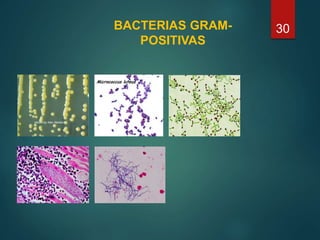 BACTERIAS GRAM-
POSITIVAS
30
 