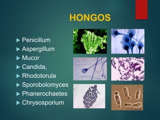 HONGOS
 Penicillum
 Aspergillum
 Mucor
 Candida,
 Rhodotorula
 Sporobolomyces
 Phanerochaetes
 Chrysosporium
 