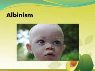 Albinism
 