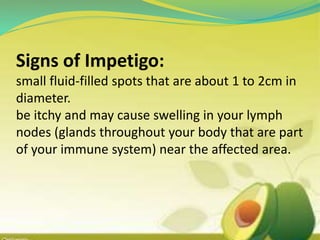 Signs of Impetigo:
small fluid-filled spots that are about 1 to 2cm in
diameter.
be itchy and may cause swelling in your lymph
nodes (glands throughout your body that are part
of your immune system) near the affected area.
 