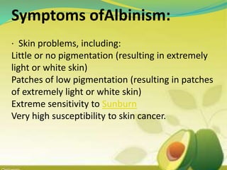 Symptoms ofAlbinism:
· Skin problems, including:
Little or no pigmentation (resulting in extremely
light or white skin)
Patches of low pigmentation (resulting in patches
of extremely light or white skin)
Extreme sensitivity to Sunburn
Very high susceptibility to skin cancer.
 