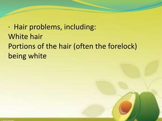 · Hair problems, including:
White hair
Portions of the hair (often the forelock)
being white
 
