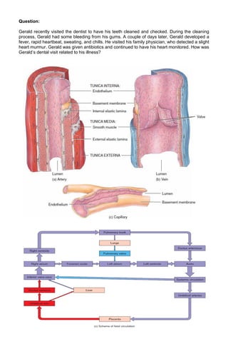 Question:
Gerald recently visited the dentist to have his teeth cleaned and checked. During the cleaning
process, Gerald had some bleeding from his gums. A couple of days later, Gerald developed a
fever, rapid heartbeat, sweating, and chills. He visited his family physician, who detected a slight
heart murmur. Gerald was given antibiotics and continued to have his heart monitored. How was
Gerald’s dental visit related to his illness?

 