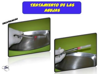 TRATAMIENTO DE LAS
     AGUJAS
 