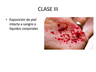 CLASE III
• Exposición de piel
intacta a sangre o
líquidos corporales
 