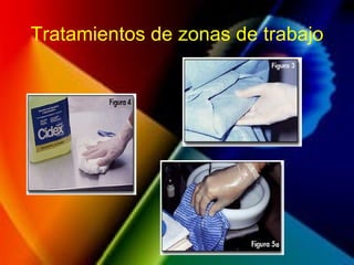Tratamientos de zonas de trabajo
 