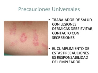 Precauciones Universales TRABAJADOR DE SALUD CON LESIONES DERMICAS DEBE EVITAR CONTACTO CON SECRESIONES. EL CUMPLIMIENTO DE ESTAS PRECAUCIONES ES RESPONZABILIDAD DEL EMPLEADOR. 