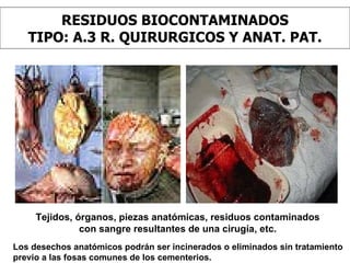 RESIDUOS BIOCONTAMINADOS TIPO: A.3 R. QUIRURGICOS Y ANAT. PAT. Tejidos, órganos, piezas anatómicas, residuos contaminados con sangre resultantes de una cirugía, etc. Los desechos anatómicos podrán ser incinerados o eliminados sin tratamiento previo a las fosas comunes de los cementerios. 