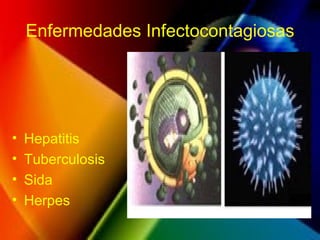 Enfermedades Infectocontagiosas Hepatitis Tuberculosis Sida Herpes 