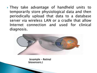 They take advantage of handheld units to temporarily store physiological data and then periodically upload that data to a database server via wireless LAN or a cradle that allow Internet connection and used for clinical diagnosis. (example - Retinal biosensors.)