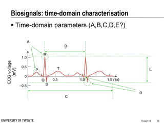 Biosignals: time-domain characterisation
 Time-domain parameters (A,B,C,D,E?)
19-Apr-18 16
A
B
E
D
C
ECGvoltage
(mV)
 