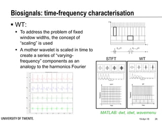  WT:
 To address the problem of fixed
window widths, the concept of
“scaling” is used
 A mother wavelet is scaled in time to
create a series of “varying-
frequency” components as an
analogy to the harmonics Fourier
Biosignals: time-frequency characterisation
19-Apr-18 26
MATLAB: dwt, idwt, wavemenu
STFT WT
 