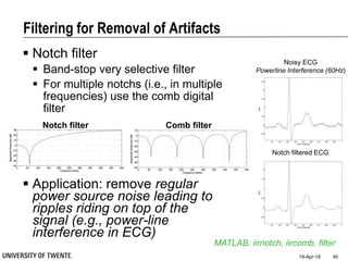 Filtering for Removal of Artifacts
 Notch filter
 Band-stop very selective filter
 For multiple notchs (i.e., in multiple
frequencies) use the comb digital
filter
 Application: remove regular
power source noise leading to
ripples riding on top of the
signal (e.g., power-line
interference in ECG)
19-Apr-18 40
MATLAB: iirnotch, iircomb, filter
Noisy ECG
Powerline Interference (60Hz)
Notch filtered ECG
Notch filter Comb filter
 