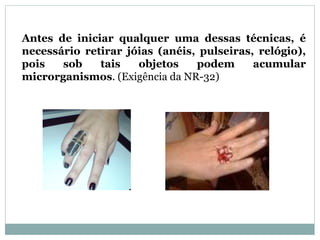 Antes de iniciar qualquer uma dessas técnicas, é
necessário retirar jóias (anéis, pulseiras, relógio),
pois sob tais objetos podem acumular
microrganismos. (Exigência da NR-32)
 