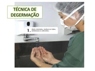 TÉCNICA DE
DEGERMAÇÃO
 