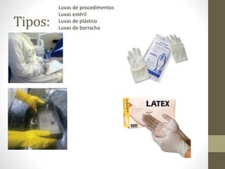 Tipos:
Luvas de procedimentos
Luvas estéril
Luvas de plástico
Luvas de borracha
 