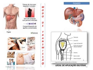 FIGADO 
M 
O 
D 
O 
D 
E 
T 
R 
A 
N 
S 
M 
I 
S 
S 
Ã 
O 
LOCAL DE APLICAÇÃO DELTÓIDE 
07/09/2014 55 
 