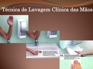 Técnica de Lavagem Clínica das Mãos
 
