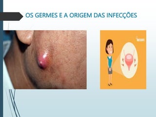 OS GERMES E A ORIGEM DAS INFECÇÕES
 