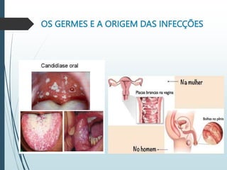 OS GERMES E A ORIGEM DAS INFECÇÕES
 