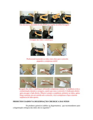 Uso de escova descartável com PVPI nas regiões de difícil lavagem
Enxágüe das mãos e antebraços
Profissional mantendo as mãos mais altas que o cotovelo
pegando a compressa estéril
Secagem das mãos e antebraços utilizando compressas estéreis. A seqüência evita a
contaminação durante a secagem, a parte que seca o cotovelo é virada para dentro
após enxugar o lado direito. Observe sempre a seqüência, primeiro as mãos, apóso
braço somente em um sentido até o cotovelo, vire a compressa e faça a mesma
seqüência do lado oposto.
PRODUTOS USADOS NA DEGERMAÇÃO CIRURGICA DAS MÃOS
Os produtos químicos (sabões ou degermantes), que recomendamos para
a degermação cirúrgica das mãos são os seguintes32
:
 