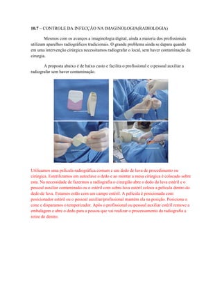 10.7 – CONTROLE DA INFECÇÃO NA IMAGINOLOGIA(RADIOLOGIA)
Mesmos com os avanços a imaginologia digital, ainda a maioria dos profissionais
utilizam aparelhos radiográficos tradicionais. O grande problema ainda se depara quando
em uma intervenção cirúrgica necessitamos radiografar o local, sem haver contaminação da
cirurgia.
A proposta abaixo é de baixo custo e facilita o profissional e o pessoal auxiliar a
radiografar sem haver contaminação.
Utilizamos uma película radiográfica comum e um dedo de luva de procedimento ou
cirúrgica. Esterilizamos em autoclave o dedo e ao montar a mesa cirúrgica é colocado sobre
esta. Na necessidade de fazermos a radiografia o cirurgião abre o dedo da luva estéril e o
pessoal auxiliar contaminado ou o estéril com sobre-luva estéril coloca a película dentro do
dedo de luva. Estamos estão com um campo estéril. A película é posicionada com
posicionador estéril ou o pessoal auxiliar/profissional mantém ela na posição. Posiciona o
cone e disparamos o temporizador. Após o profissional ou pessoal auxiliar estéril remove a
embalagem e abre o dedo para a pessoa que vai realizar o processamento da radiografia a
retire de dentro.
 