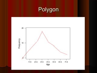 PolygonPolygon
71.561.551.541.531.521.511.5
20
10
0
Age
Frequency
 