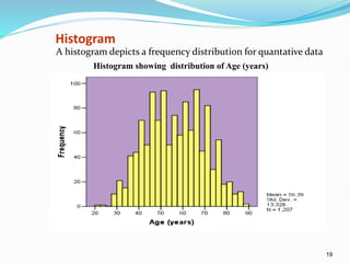 19
Histogram
A histogram depicts a frequency distribution for quantative data
Histogram showing distribution of Age (years)
 