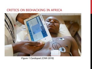 CRITICS ON BIOHACKING IN AFRICA
Figure 1 Cardiopad (CNN 2016)
 