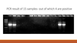 PCR result of 15 samples- out of which 4 are positive
 