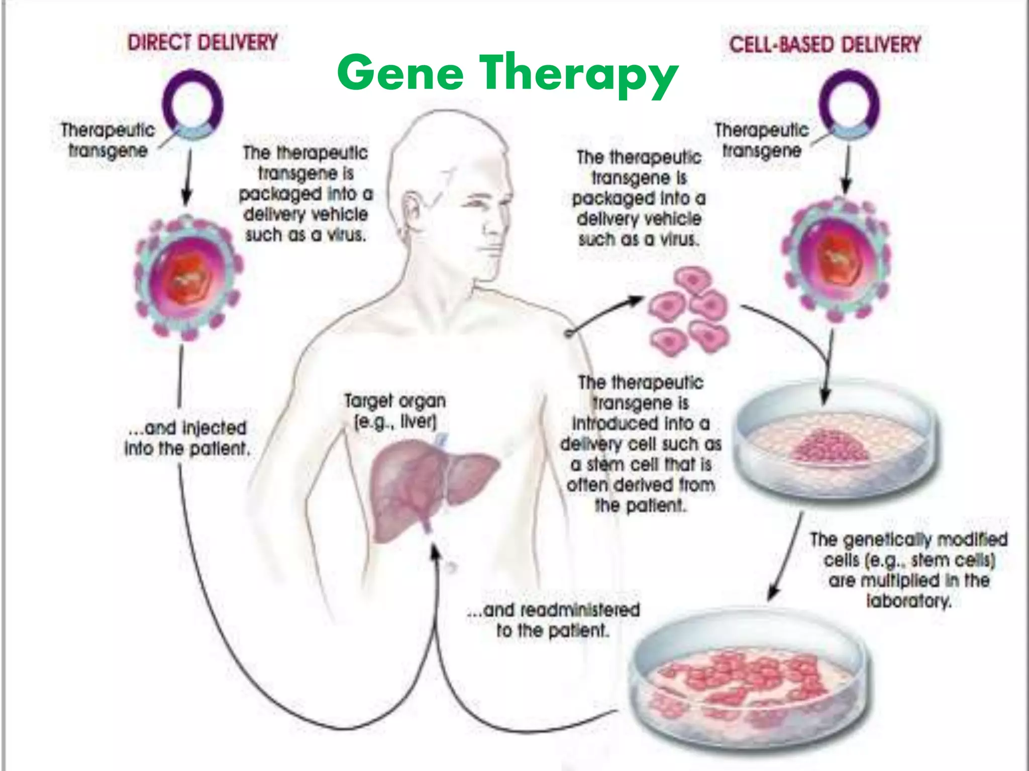 Gene Therapy
 