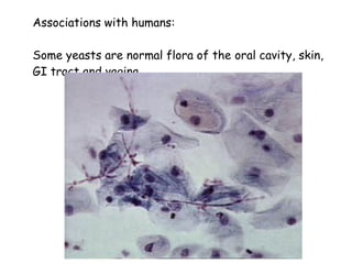 Associations with humans: Some yeasts are normal flora of the oral cavity, skin,  GI tract and vagina 