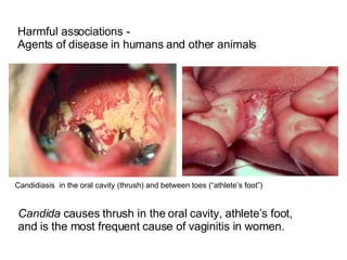 Harmful associations - Agents of disease in humans and other animals Candida  causes thrush in the oral cavity, athlete’s foot, and is the most frequent cause of vaginitis in women.  Candidiasis  in the oral cavity (thrush) and between toes (“athlete’s foot”) 