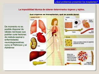 La imposibilidad técnica de obtener determinados órganos y tejidos.La imposibilidad técnica de obtener determinados órganos y tejidos.
De momento no esDe momento no es
posible disponer deposible disponer de
células nerviosas quecélulas nerviosas que
podrían curar lesionespodrían curar lesiones
de médula espinal ode médula espinal o
enfermedadesenfermedades
neurodegenerativasneurodegenerativas
como el Párkinson y elcomo el Párkinson y el
AlzhéimerAlzhéimer
¿Qué problemas presentan los trasplantes?¿Qué problemas presentan los trasplantes?
 