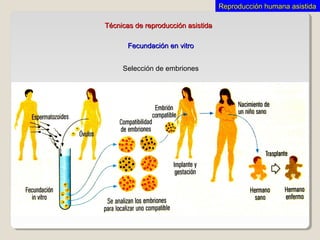 Técnicas de reproducción asistidaTécnicas de reproducción asistida
Fecundación en vitroFecundación en vitro
Selección de embriones
Reproducción humana asistidaReproducción humana asistida
 