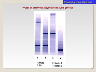 Proyecto genoma humanoProyecto genoma humano
Prueba de paternidad apoyadas en la huella genéticaPrueba de paternidad apoyadas en la huella genética
 