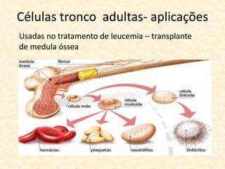 Células tronco adultas- aplicações
Usadas no tratamento de leucemia – transplante
de medula óssea
 