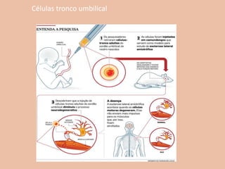 Células tronco umbilical
 