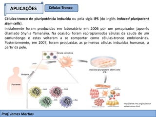 APLICAÇÕES Células-Tronco
Prof. James Martins
Inicialmente foram produzidas em laboratório em 2006 por um pesquisador japonês
chamado Shynia Yamanaka. Na ocasião, foram reprogramadas células da cauda de um
camundongo e estas voltaram a se comportar como células-tronco embrionárias.
Posteriormente, em 2007, foram produzidas as primeiras células induzidas humanas, a
partir da pele.
Células-tronco de pluripotência induzida ou pela sigla iPS (do inglês induced pluripotent
stem cells).
http://www.rntc.org.br/ceacut
elulas-tronco.html
 