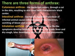 There are three forms of anthrax:
Cutaneous anthrax - the bacterium enters through a cut
in the skin, resulting to skin sores with characteristic black
center.
Intestinal anthrax - bacterium ingested from meat of
infected animal causes inflammation of the intestines,
vomiting of blood and severe diarrhea.
Inhalation anthrax - infects the lungs; cold or flu-like
symptoms develop initially, with fatigue, low grade fever and
dry cough, later developing into high fever and pneumonia.
 