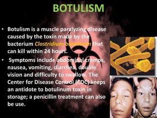 BOTULISM
• Botulism is a muscle paralyzing disease
caused by the toxin made by the
bacterium Clostridium botulinum that
can kill within 24 hours.
• Symptoms include abdominal cramps,
nausea, vomiting, diarrhea, double
vision and difficulty to swallow. The
Center for Disease Control (CDC) keeps
an antidote to botulinum toxin in
storage; a penicillin treatment can also
be use.
 