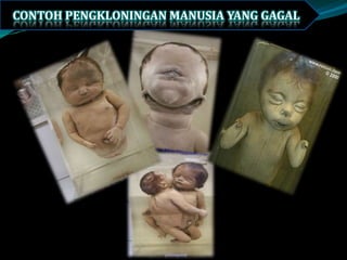 CONTOH PENGKLONINGAN MANUSIA YANG GAGAL
 