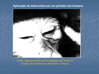 Aplicação de tuberculina em um primata não-humano

Fonte: Departamento de Primatologia do Centro de
Criação de Animais de Laboratório / Fiocruz.

 