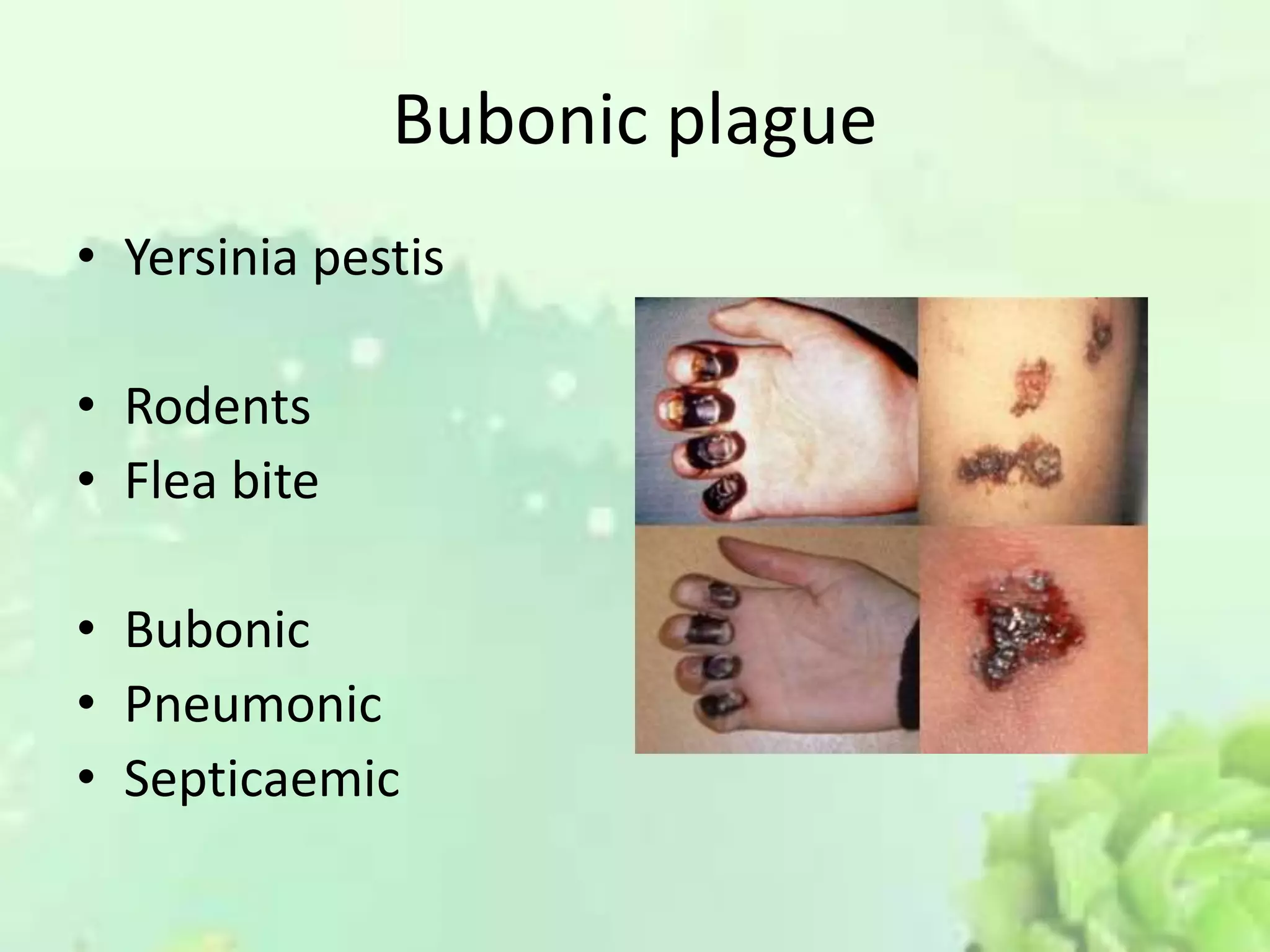 Bubonic plague
• Yersinia pestis
• Rodents
• Flea bite
• Bubonic
• Pneumonic
• Septicaemic
 